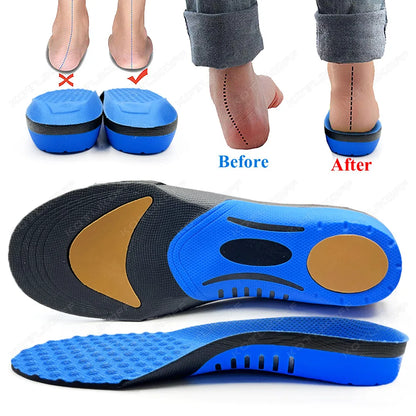 Orthopedic Insoles